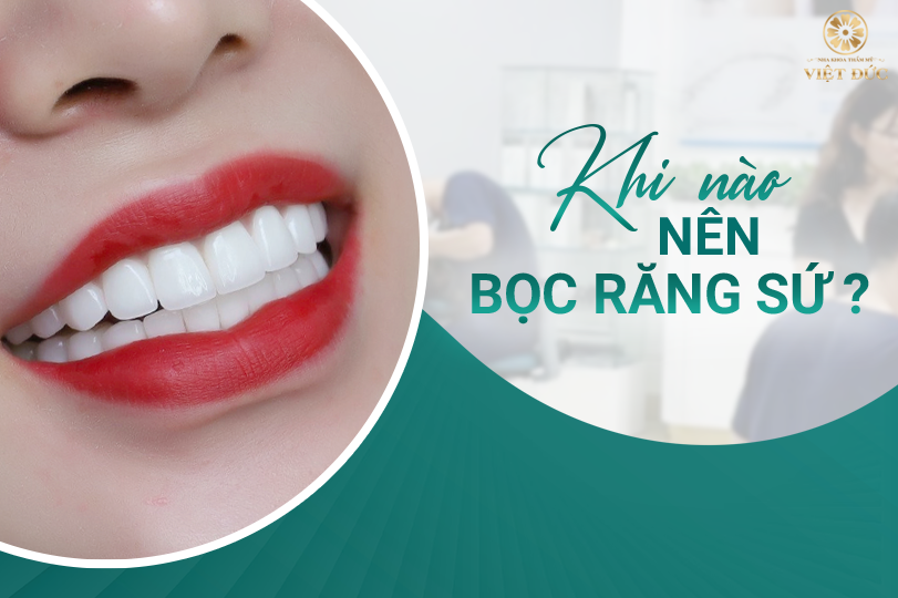 khi nào nên bọc răng sứ